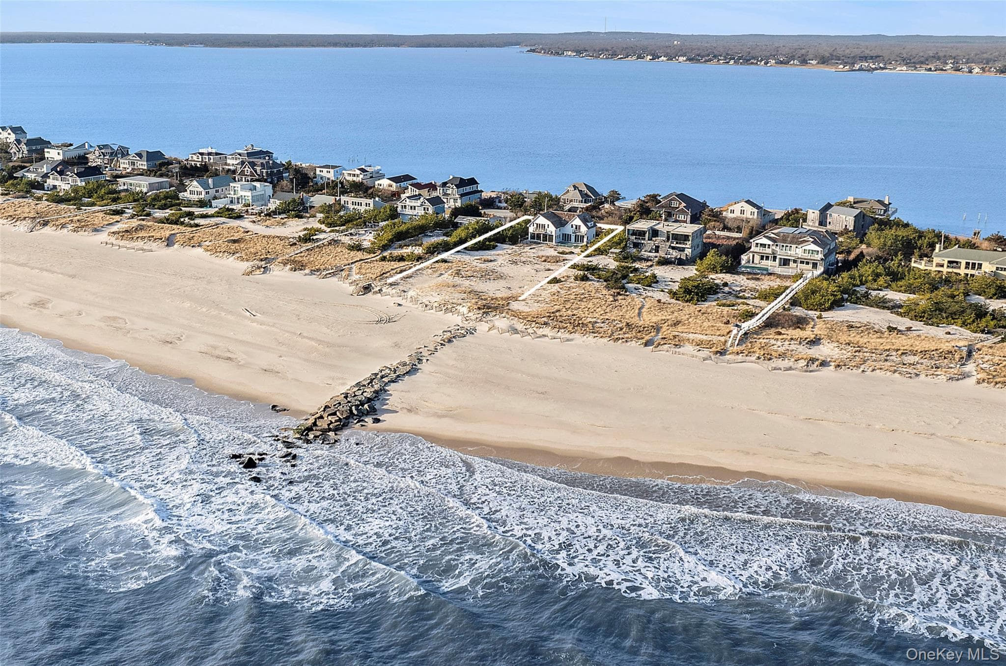 617 Dune Road thumbnail 2